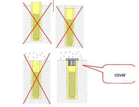rail plastic dowel rail plastic dowel